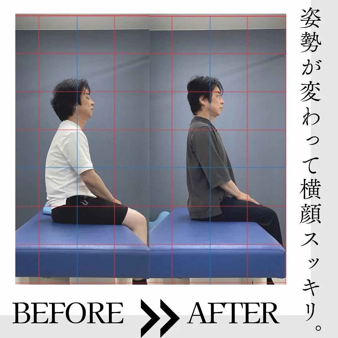 Before▶︎After