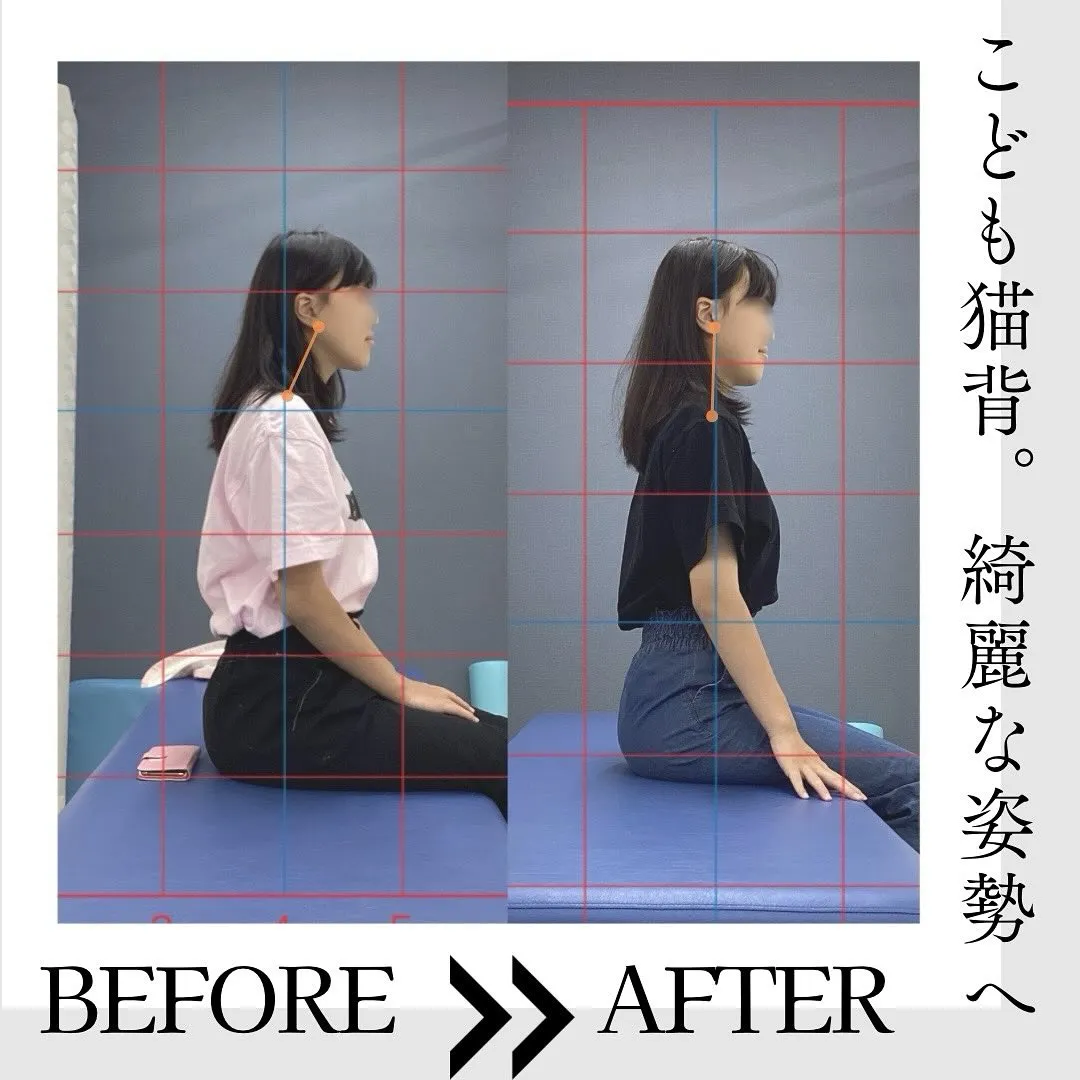 Before▶︎After