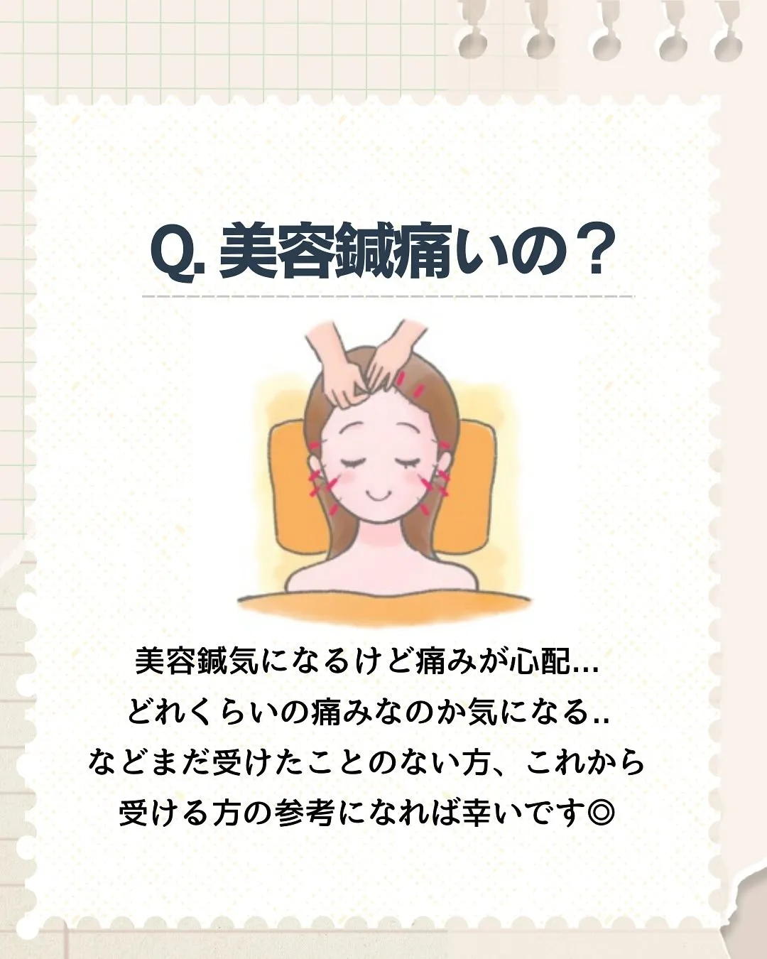 美容鍼痛くないの🪡？